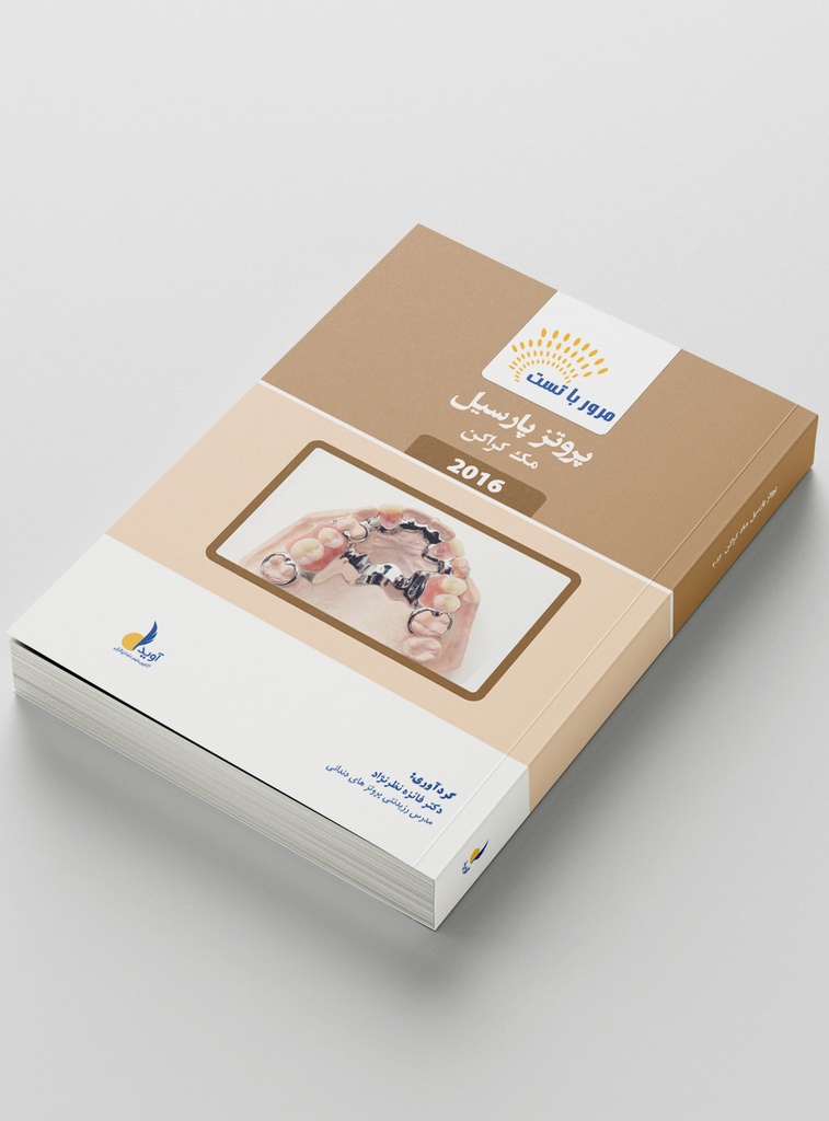 مرور با تست پروتز پارسیل